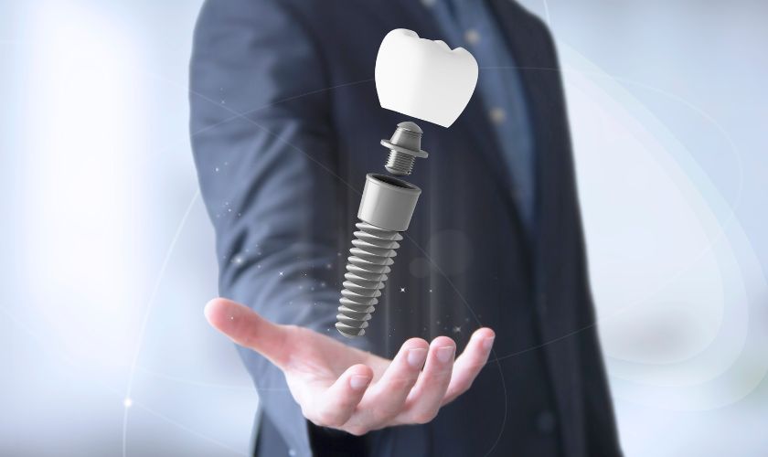 Dental Implants Treatments in Erie