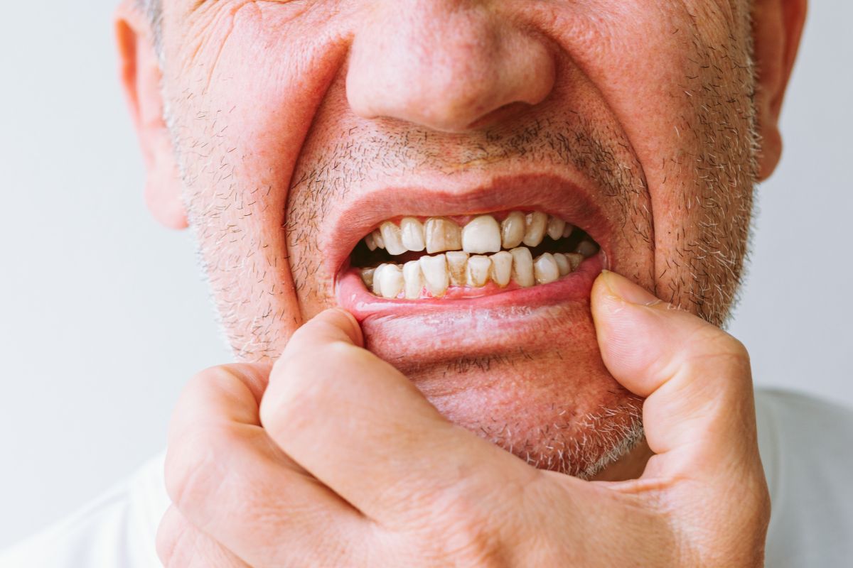 Stained Teeth During Holiday Meals