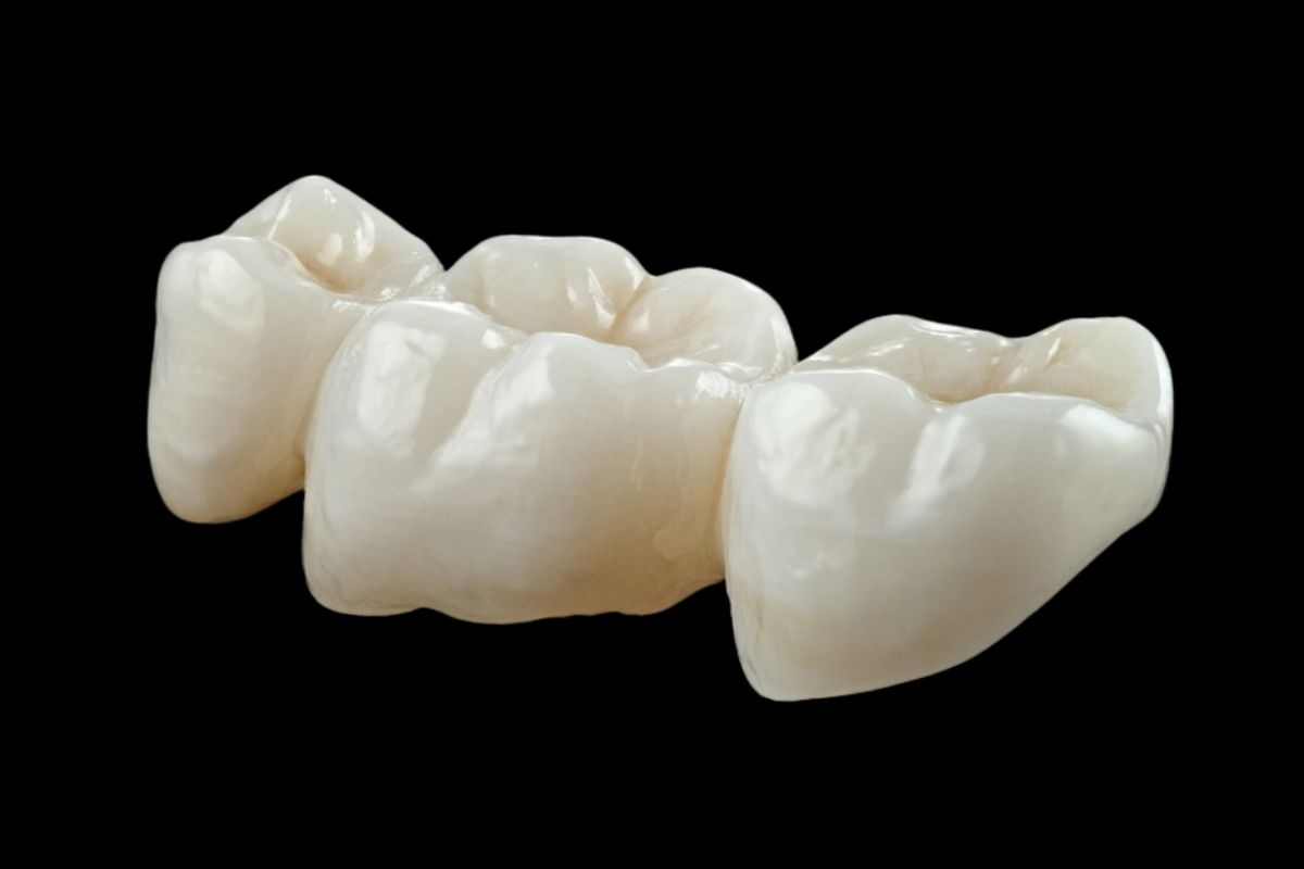 dental crown